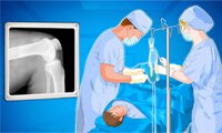 Operate Now: Knee Surgery