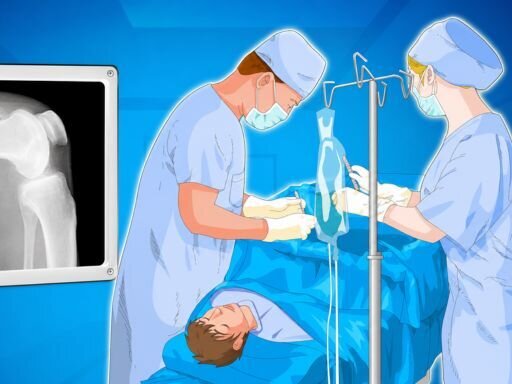 Operate Now: Knee Surgery